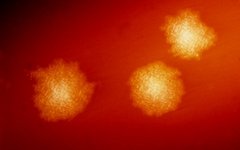 Clostridium difficile. Фото с сайта wikimedia.org