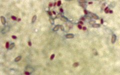Mycobacterium smegmatis. Фото с сайта wikimedia.org