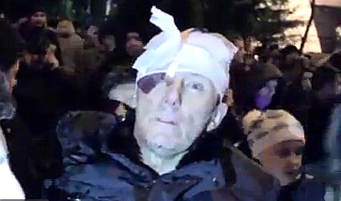 Юрий Луценко после избиения. Стоп-кадр с видео в YouTube