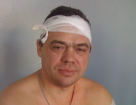 Раненый украинский солдат. Фото со страницы пресс-службы АТО в Facebook 